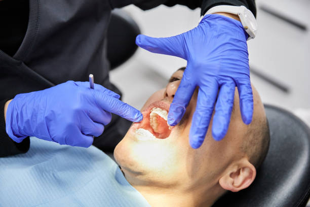 Best Dentist for Tooth Abscess  in Caribou, ME